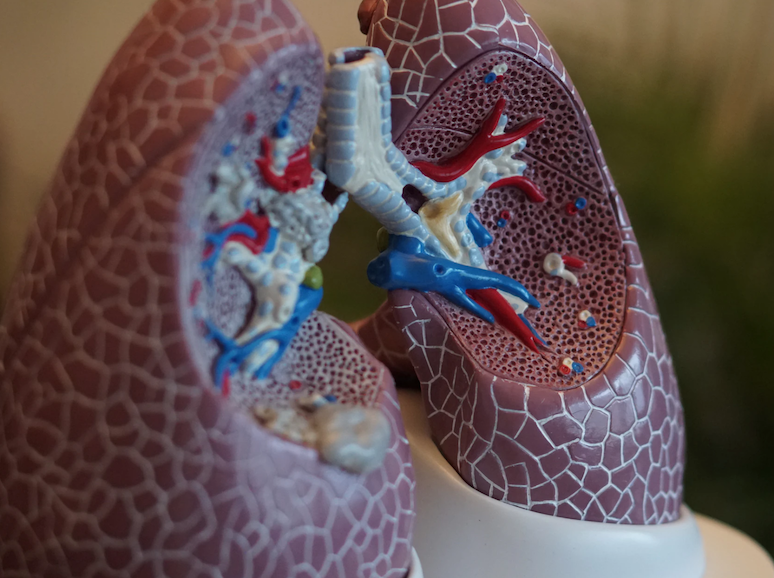 lung