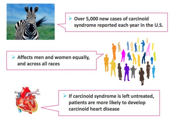 Carcinoid Syndrome Rare Disease